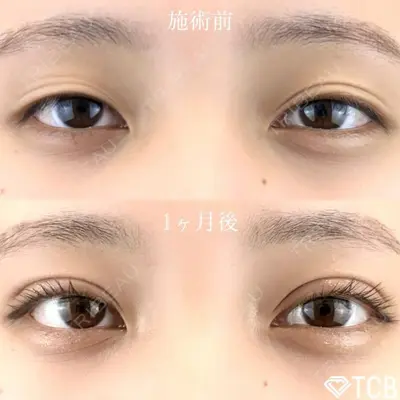 TCB東京中央美容外科 福島院の症例