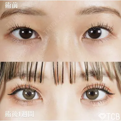 TCB東京中央美容外科 徳島院の症例