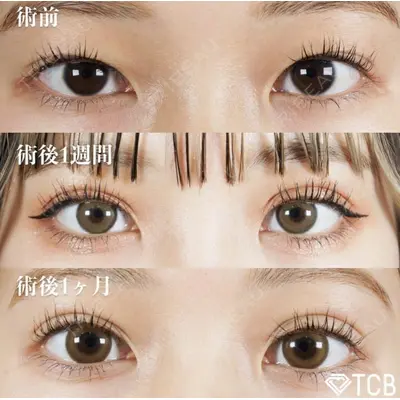 TCB東京中央美容外科 徳島院の症例