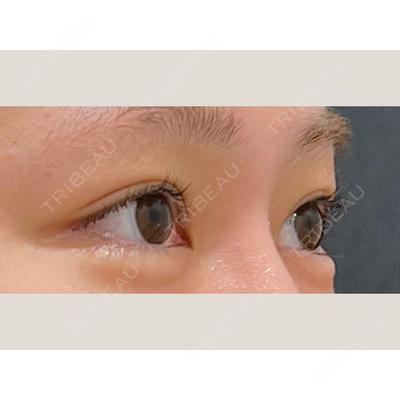 veary clinic 井上 裕章医師の症例