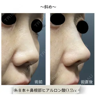 あいちビューティークリニックの症例