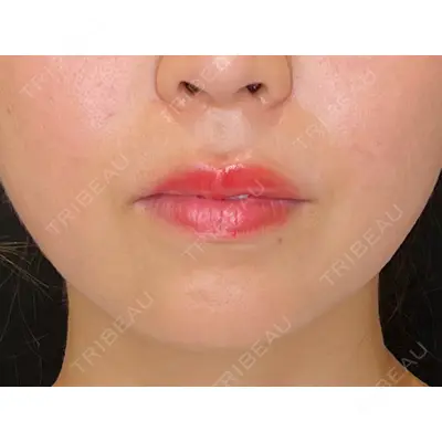 veary clinic 井上 裕章医師の症例
