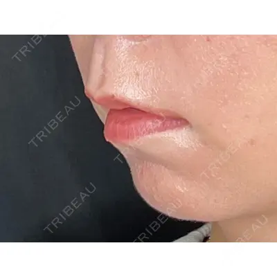 veary clinic 井上 裕章医師の症例