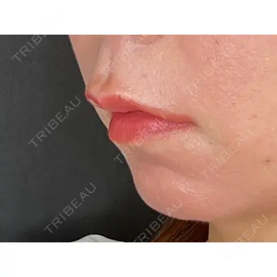 veary clinic 井上 裕章医師の症例