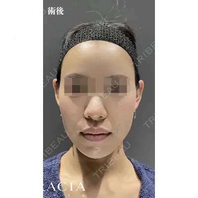 GRACIA clinic 【グラシアクリニック】の症例