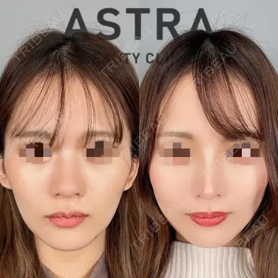 ASTRA BEAUTY CLINICの症例