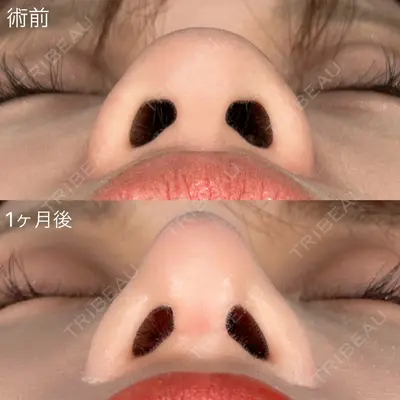 ASTRA BEAUTY CLINICの症例