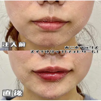 ルラ美容クリニック 池袋院 小海 元｜長期休暇につき指名不可医師の症例