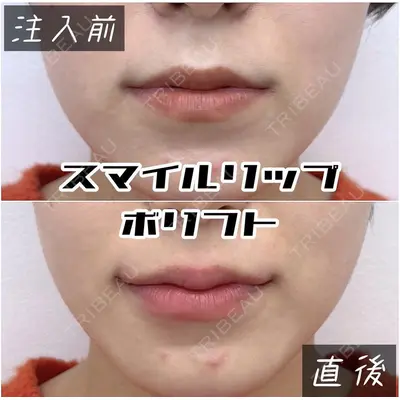ルラ美容クリニック 池袋院 小海 元｜長期休暇につき指名不可医師の症例