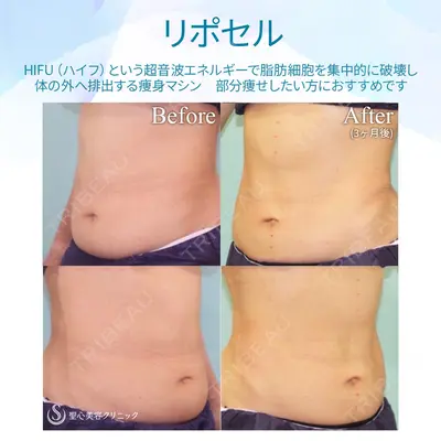 聖心美容クリニック 銀座院 牧野 陽二郎医師の症例