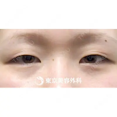 東京美容外科 秋田院の症例
