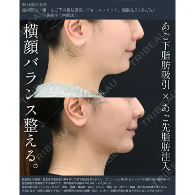 湘南美容クリニック 秋葉原院 名倉 俊輔医師の症例