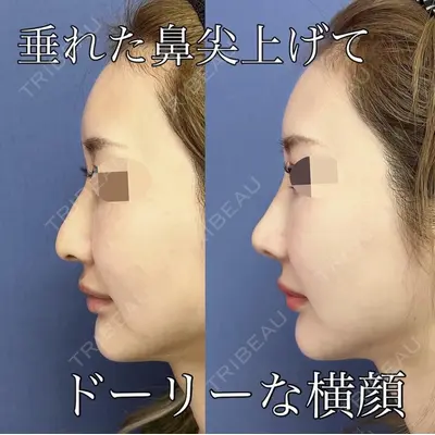 グローバルビューティークリニック 大阪院の症例