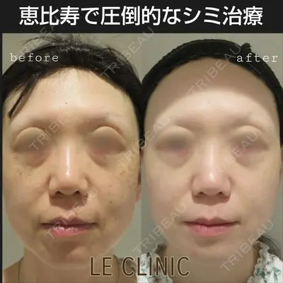LE CLINIC 喜多　俊博医師の症例