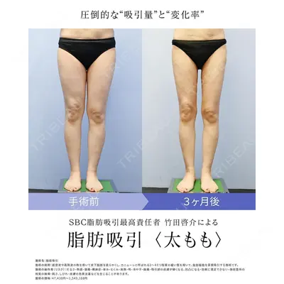 湘南美容クリニック 新橋銀座口院 竹田 啓介医師の症例