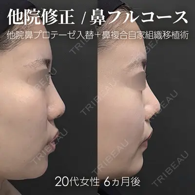 ジョウクリニック 銀座院 重本　譲医師の症例