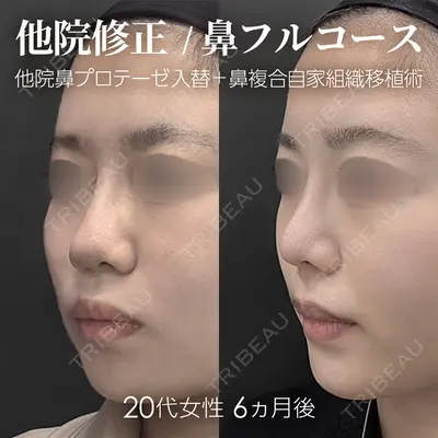 ジョウクリニック 銀座院 重本　譲医師の症例