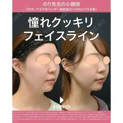 湘南美容クリニック 秋葉原院の症例