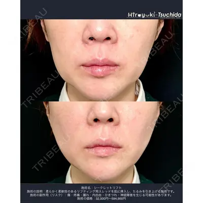 湘南美容クリニック 秋葉原院の症例