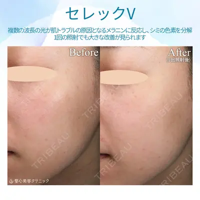 聖心美容クリニック 熱海院 小林 美幸（皮膚科）医師の症例