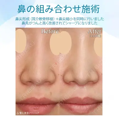 聖心美容クリニック 六本木院 菱田 健作医師の症例