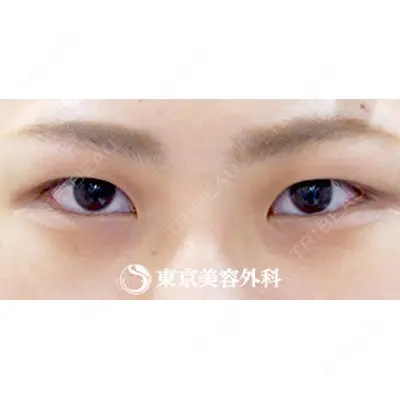 東京美容外科 梅田院 木村 幸志伊医師の症例