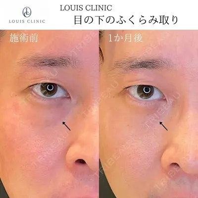 LOUIS CLINIC 二子玉川院【ルイクリニック】 小松 塁医師の症例