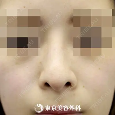 東京美容外科 沖縄院の症例