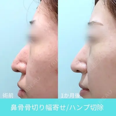WOM CLINIC GINZA （ワム クリニック ギンザ） 佐々木 和司医師の症例