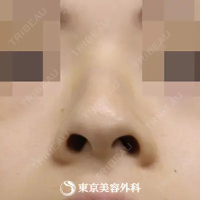 東京美容外科 札幌院の症例