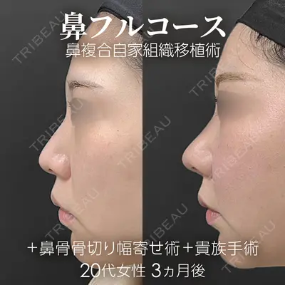 ジョウクリニック 銀座院 重本　譲医師の症例