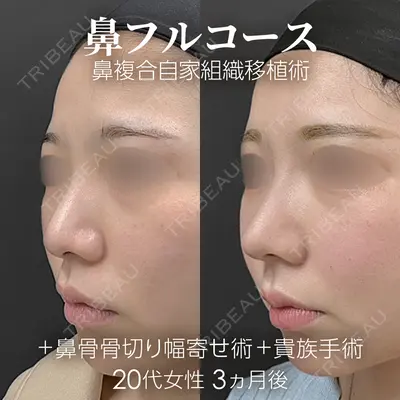 ジョウクリニック 銀座院 重本　譲医師の症例