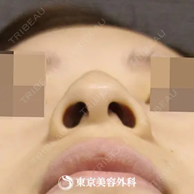 東京美容外科 沖縄院の症例