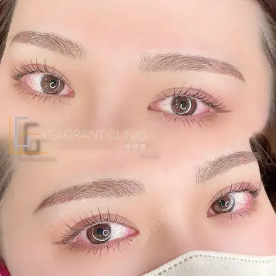 LEAGRANT CLINIC 中目黒 谷上 奈緒子医師の症例