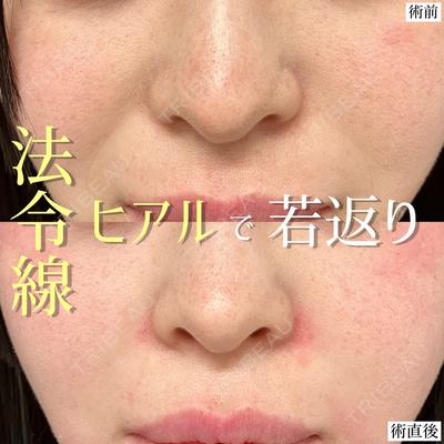 東京シンデレラ美容外科 大宮院の症例
