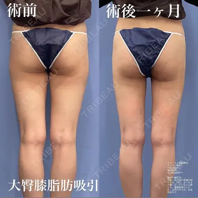 湘南美容クリニック 浜松院の症例