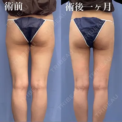 湘南美容クリニック 浜松院の症例