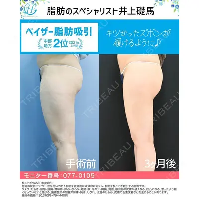 湘南美容クリニック 浜松院の症例
