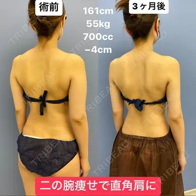 湘南美容クリニック 銀座院 葛島 魁人医師の症例