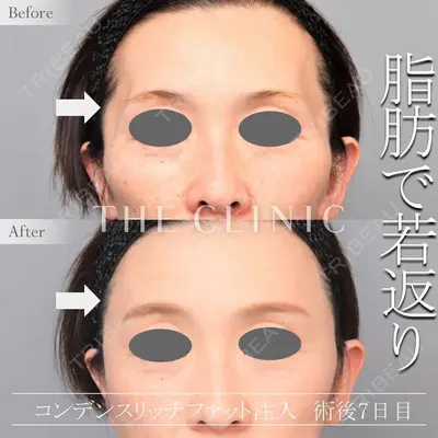 THE CLINIC（ザ・クリニック） 東京院 今西 理也医師の症例