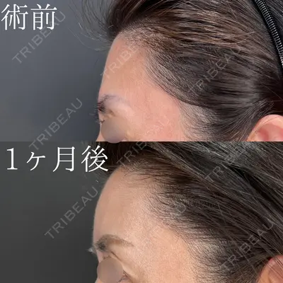 HAAB×DREAM BEAUTY CLINIC 大阪梅田院 鈴木 馨斗医師の症例