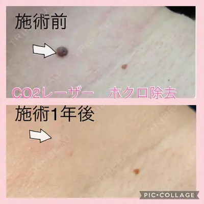 大塚美容形成外科 札幌院の症例