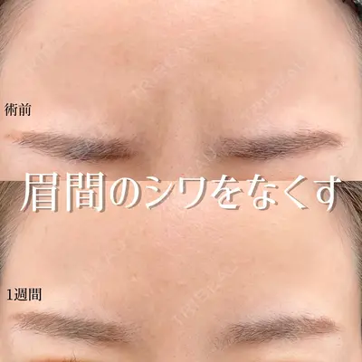 東京シンデレラ美容外科 大宮院の症例
