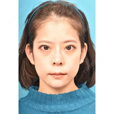 アネシス美容クリニック 水野　力医師の症例