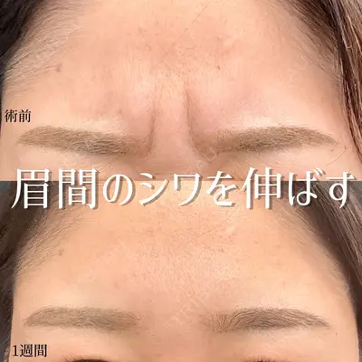 東京シンデレラ美容外科 大宮院の症例