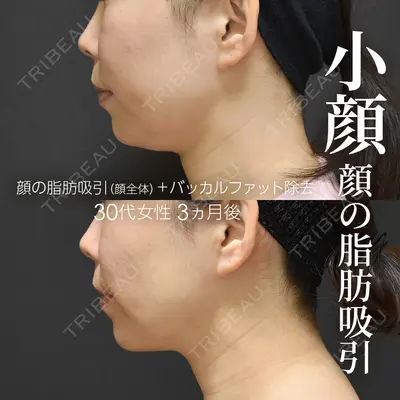 ジョウクリニック 銀座院 重本　譲医師の症例
