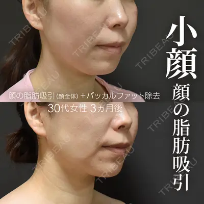 ジョウクリニック 銀座院 重本　譲医師の症例