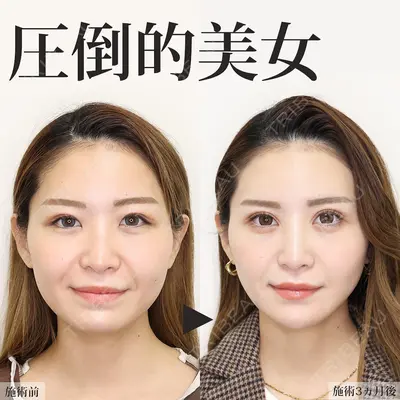 銀座TAクリニック 山田 真里江医師の症例