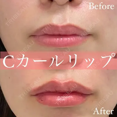 ルラ美容クリニック 名古屋本院 酒井 俊行医師の症例