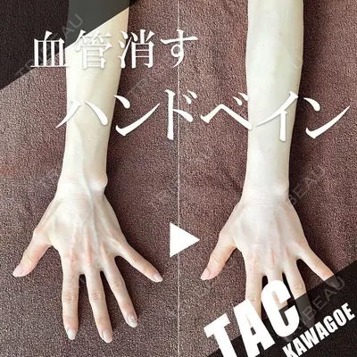 川越TAクリニックアソシエ 志村 一馬医師の症例
